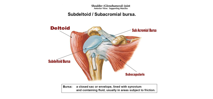 Subdeltoid Bursitis